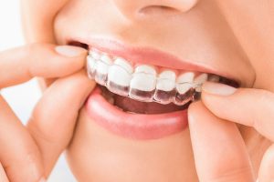 Customized digital orthodontics